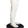 Model akupunktura