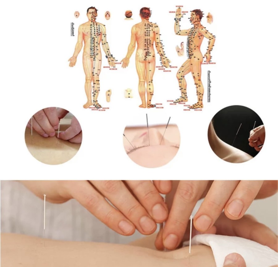 Igły do akupunktury