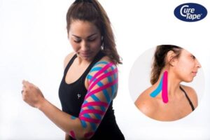 kinesiotaping