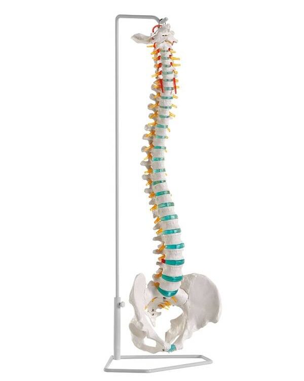 Model kręgosłupa z dyskopatią