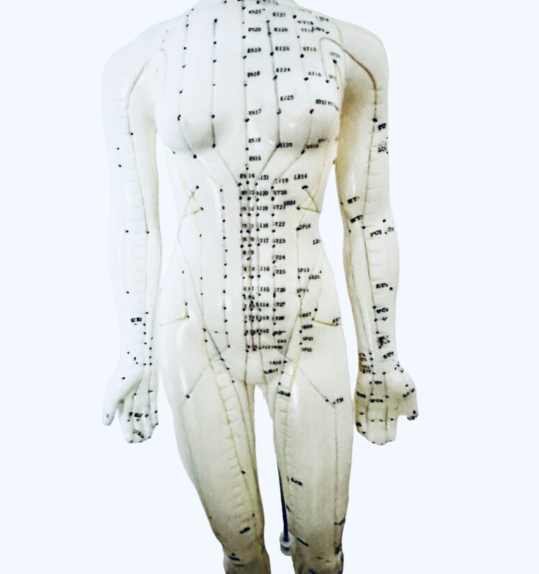 model akupunktura